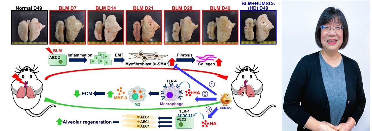 Treat Pulmonary Fibrosis Through Allogeneic Transplantation of Human Umbilical Mesenchymal Stem Cells